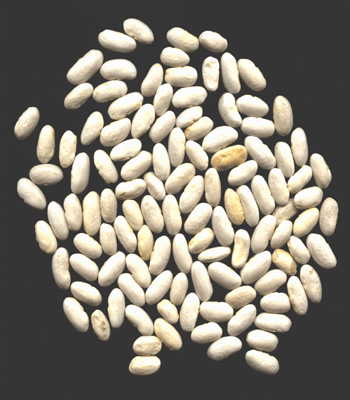 White Kidney